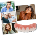 Carillas dentales Snap-On