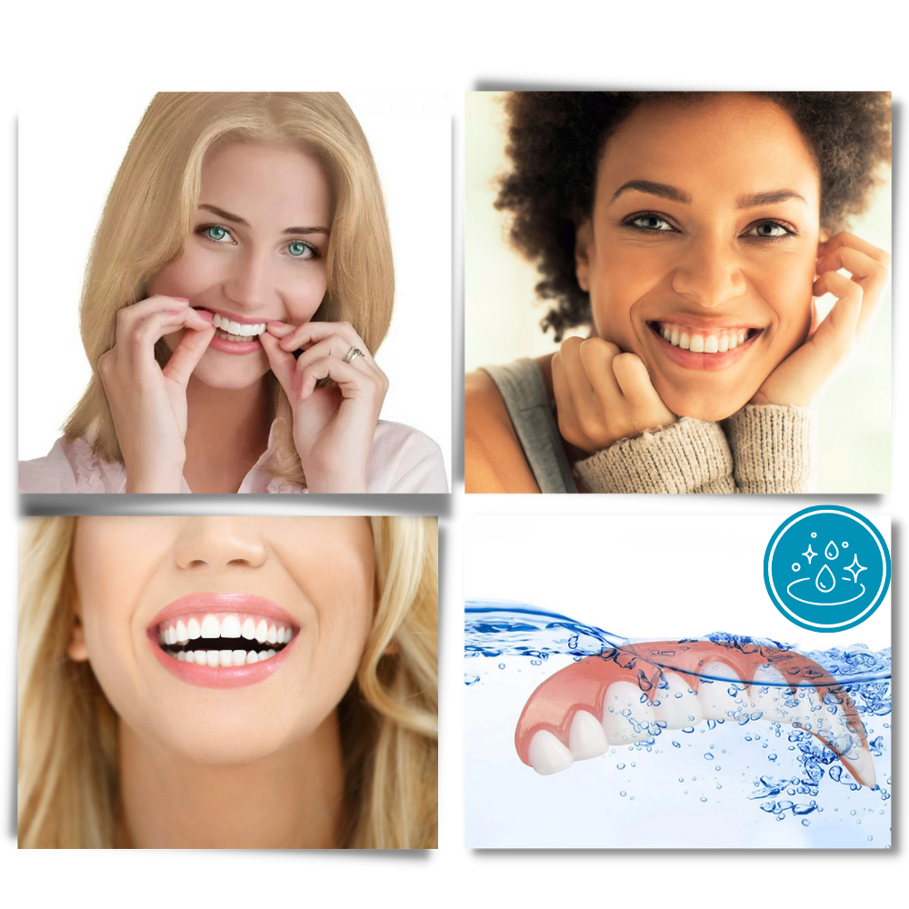 Carillas dentales Snap-On