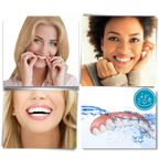 Carillas dentales Snap-On