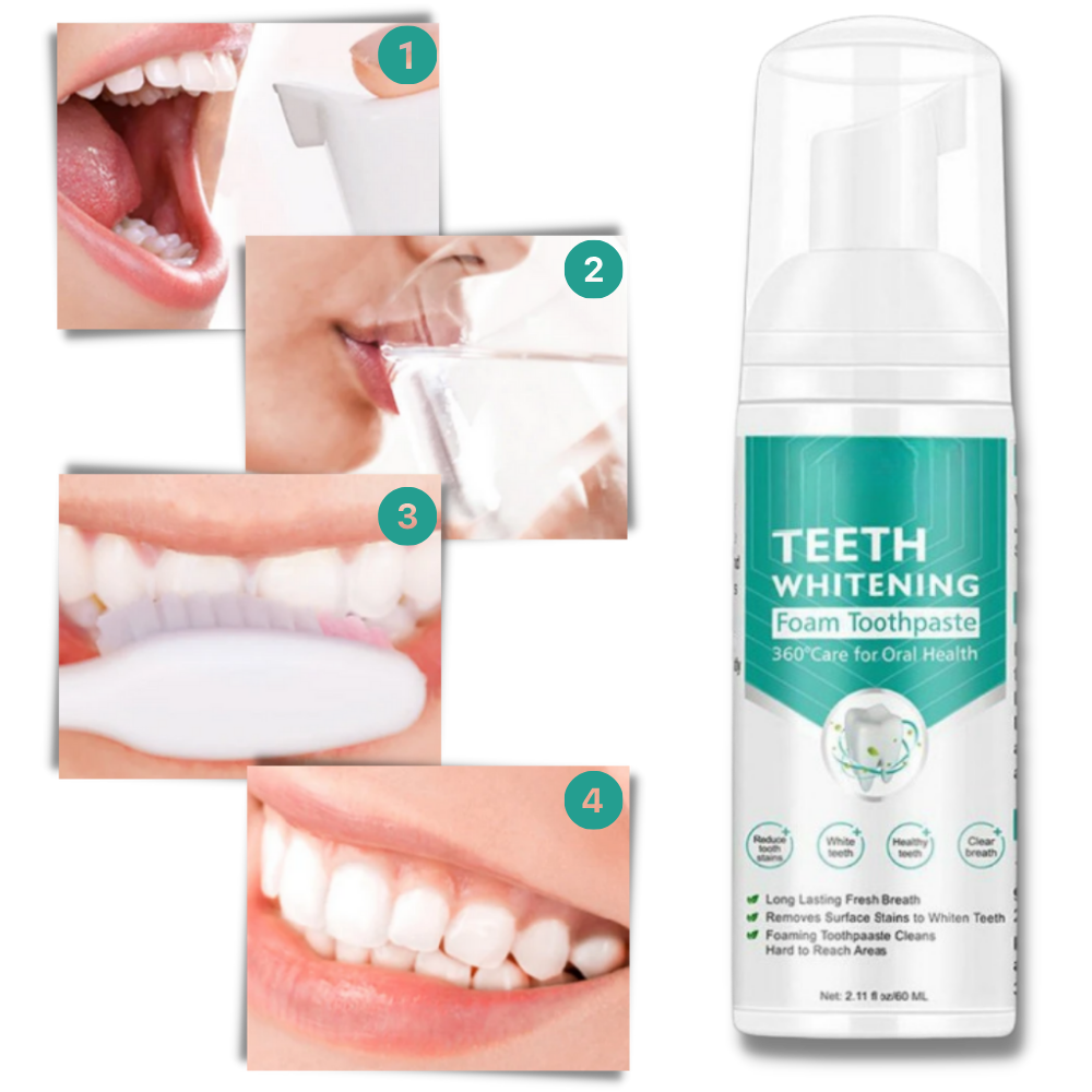 Espuma blanqueadora dental