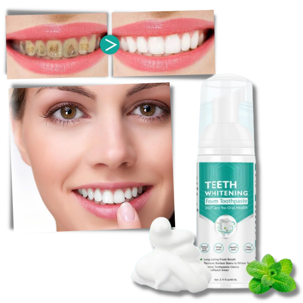 Espuma blanqueadora dental