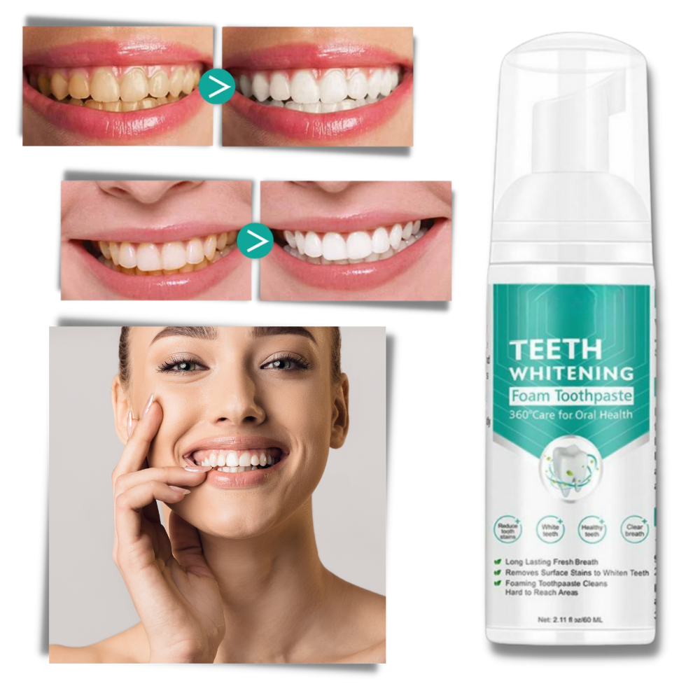 Espuma blanqueadora dental