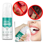 Espuma blanqueadora dental