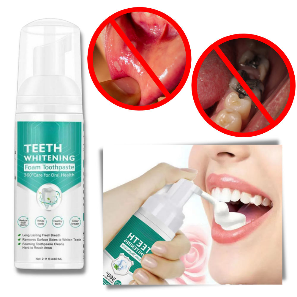 Espuma blanqueadora dental