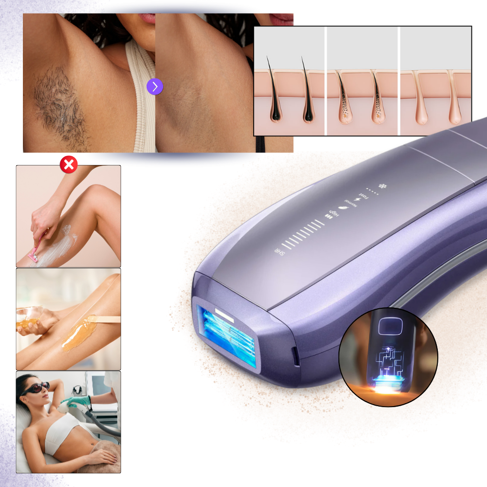 Depiladora IPL SkinSync