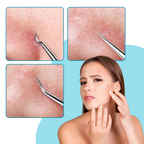 Pinzas faciales de alta precisión