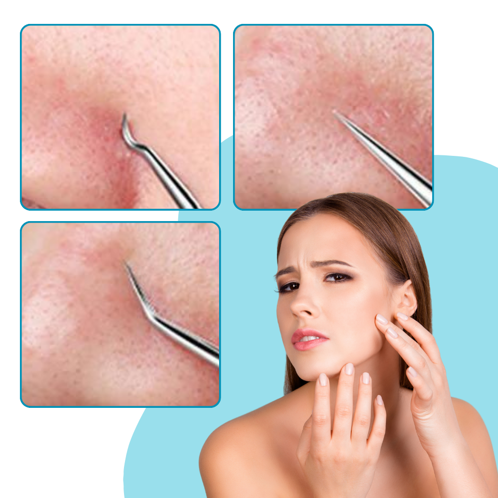 Pinzas faciales de alta precisión